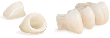 dental crowns Whitefish, MT